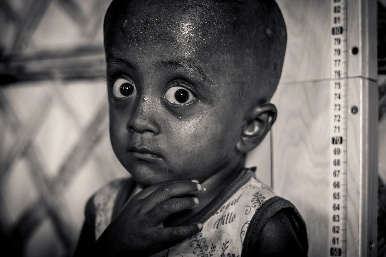 Rohingya Refugees — 18